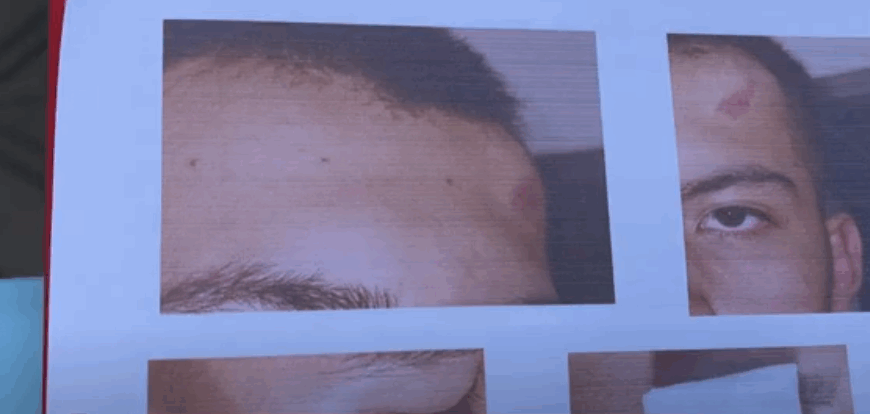 ABOGADO AFIRMA QUE AGRESIÓN EN LA SALLE ES UN DELITO POR LESIONES GRAVÍSIMAS