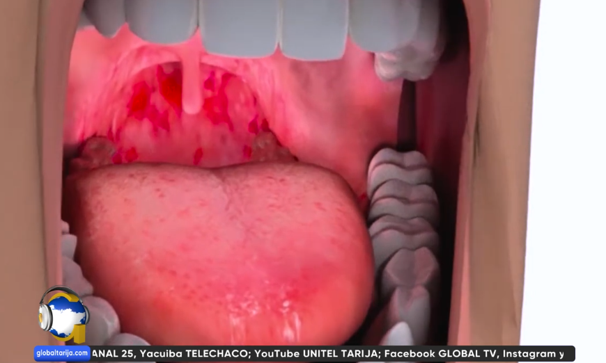 RECOMIENDAN CONTROLES PARA EVITAR CÁNCER&hellip;